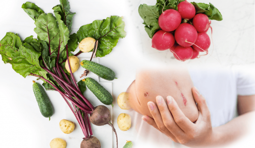 Foods which help to recover wound